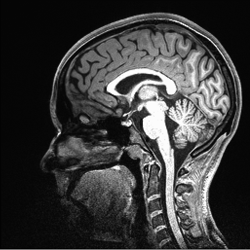 A scan of a human brain taken in the Pain Brain Study at OHSU, which is a study of brain and behavioral risks for acute to chronic pain. This scan is a possible benefit for the participant as it can help catch any issues. Photo via Hailie Robertson. 